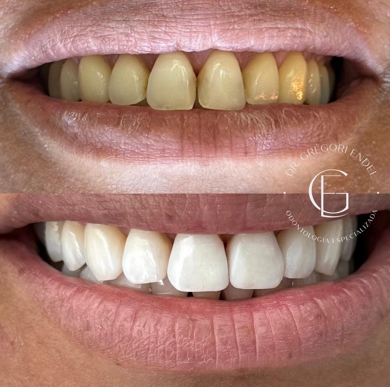 imagem_padronizada_1