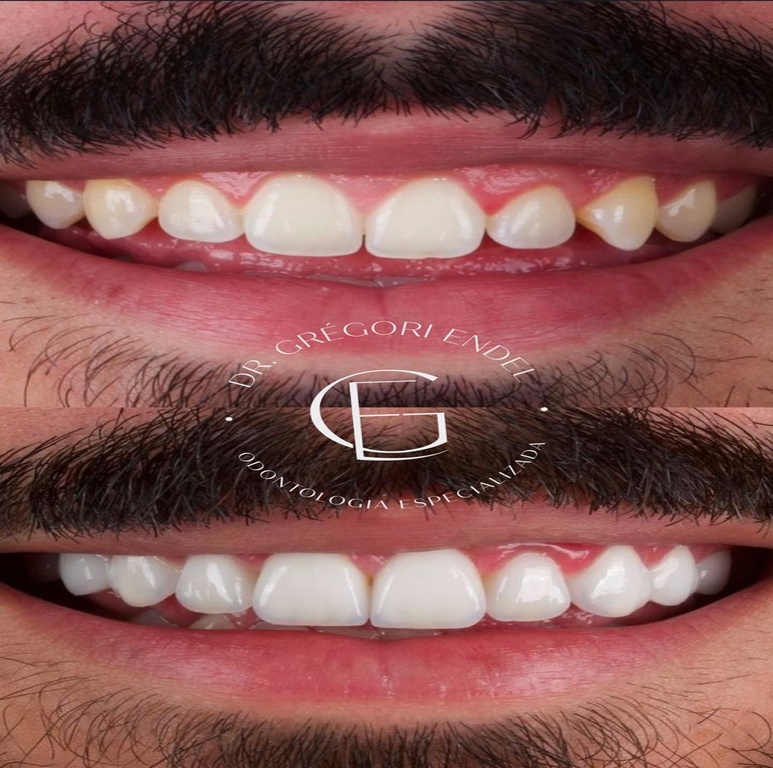 imagem_padronizada_2